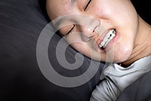 Asian child girl suffering from bruxism while lying in bed at night,female grinding of the teeth during sleep,teeth clenching, photo