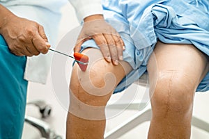 Asian doctor use hammer knock senior woman patient to check knee reflex, nerve and muscle in hospital