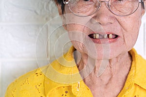 Asian Elderly woman over 70 years old be smile with a few broken teeth here have problem of ability to chew food of the elderly.