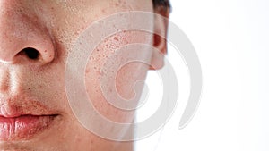 Asian face, Macro skin with enlarged pores. Allergic reaction, peeling, care for skin.