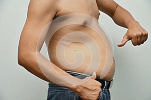 Asian fat man has cholesterol . He shows excess fat of the tummy