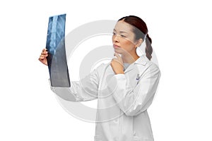 Asian female doctor looking at x-ray of spine