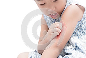 asian girl scratch the itch with hand her arm because of mosquito