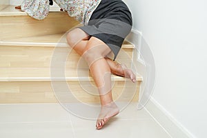 Asian lady woman injuries from falling down on slippery surfaces stairs at home