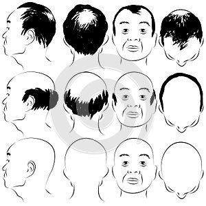 Asian Male Baldness Pattern photo