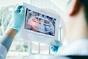 Asian male dentists are analyzing x-ray images of patients at th