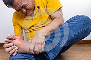 Asian man with hand embracing inflammed foot with painful gout photo