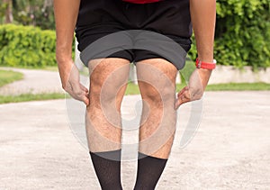 Asian man leg bandy-legged shape of the leg