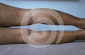 Asian man leg bandy-legged shape of legs
