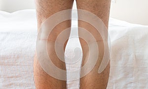 Asian man leg bandy-legged shape of the legs