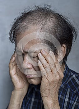 Asian man massaging his temple. Concept of eye pain, strain or cluster headache