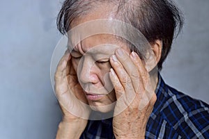 Asian man massaging his temple. Concept of eye pain, strain or cluster headache