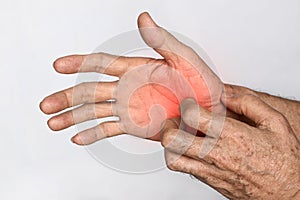 Asijský muž poškrábání jeho ruka. z svědivý kůže nemoci takový jako infekce ekzém svrab alergie 