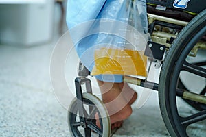 Asian middle-aged lady woman patient sitting on wheelchair with urine bag in hospital
