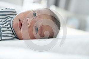 Asian Newborn baby boy lying on the bed with Common skin rash on his face at home