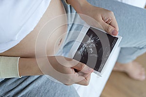 Asian pregnant woman holding ultrasound film scan of baby
