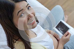 Asian pregnant woman holding ultrasound film scan of baby