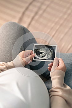 Asian pregnant woman holding ultrasound scan image, Expectation of a child and Maternity prenatal care and woman pregnancy concept