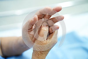 Asian senior or elderly old lady woman patient feel pain her hand on bed in nursing hospital ward : healthy strong medical.