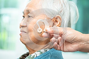 Asian senior woman patient wearing a hearing aid for treating hearing loss problem