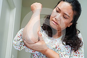 Asian senior woman wearing elastic support elbow brace for reduce pain