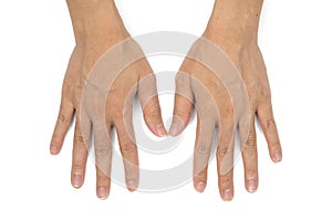 Asian woman hands with clear veins