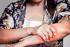 Asian woman having arm pain