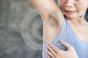 Asian woman having problem fat skin  underarm and black armpit photo