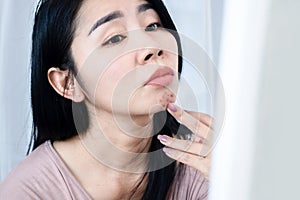 Asian woman having skin face problem with acne and scars on chin