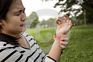 Asian woman hold her sore wrist caused by running and falling, using braced hand to hurt the wrist and hand pain at park, female