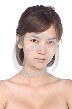 Asian Woman before make up. no retouch, fresh face with acne, sk