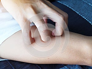 Asian woman scratching on arm from itching on skin
