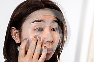 Asian woman suffering from eye inflammation feeling pain ,redness