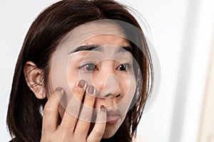 Asian woman suffering from eye inflammation feeling pain ,redness photo