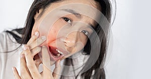 Asian woman with toothache. Seeking toothache relief and oral health care