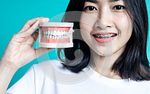 Asian woman wearing dental braces pointing to tooth sample and smiling with her healthy white teeth isolated shot on blue backgrou