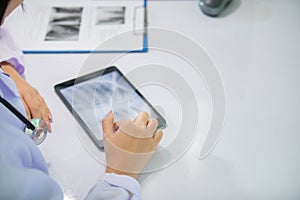 Asian women doctor  working and analyzing x-ray images  at  hospital office