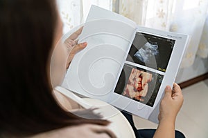 Asian young pregnant female looking cute pregnant belly and x ray ultrasound scan of baby. motherhood concept third trimester, x-