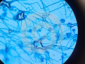 Aspergillus conidiophores stained with lactophenol cotton blue