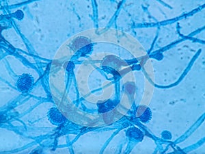 Aspergillus conidiophores stained with lactophenol cotton blue