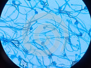 Aspergillus conidiophores stained with lactophenol cotton blue