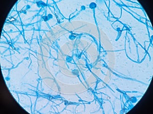 Aspergillus conidiophores stained with lactophenol cotton blue