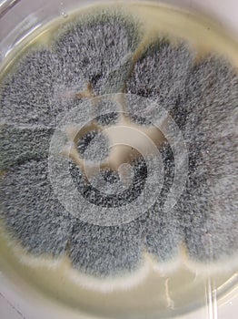 Aspergillus fumigatus colonies on saboraud dextrose agar medium photo