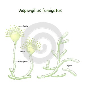 Aspergillus fumigatus is  a type of fungus causes aspergillosis photo