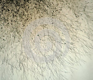 Aspergillus fumigatus under the microscope photo