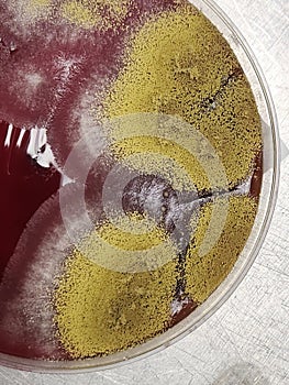 Aspergillus fungus on culture plate in Microbiology lab - yellow fruiting bodies