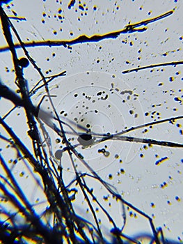 Aspergillus genus mold under the microscope
