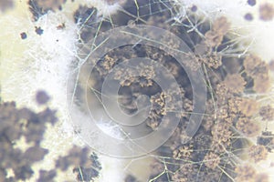 Aspergillus mold for Microbiology.