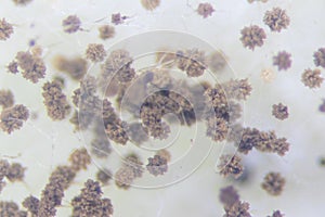 Aspergillus mold for Microbiology.