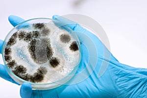 Aspergillus mold for Microbiology in Lab.